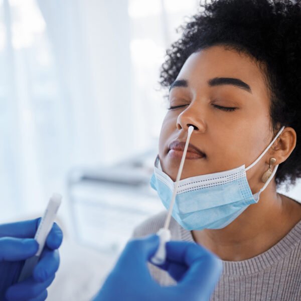 Covid-nasal - laboratório conte